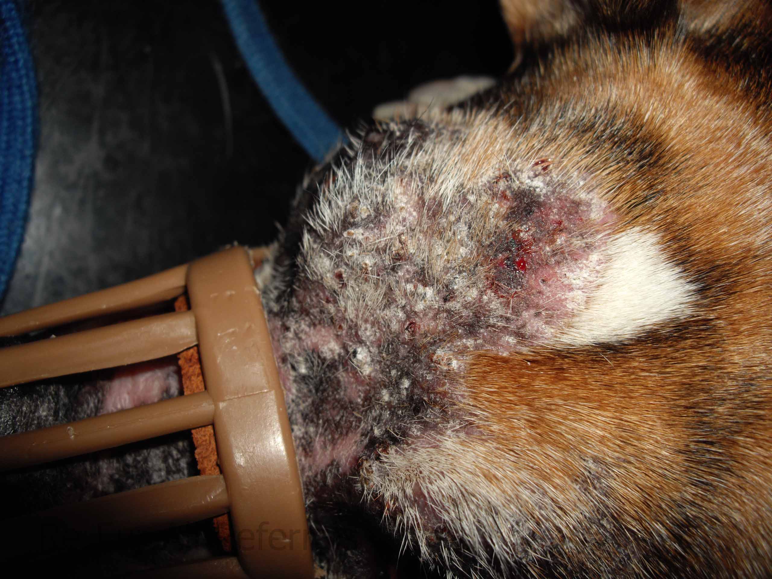 Dermatophytosis